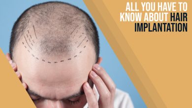Photo of All You Have to Know About Hair Implantation
