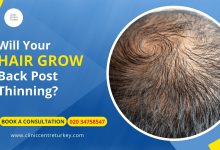 Photo of Will Your Hair Grow Back Post Thinning?